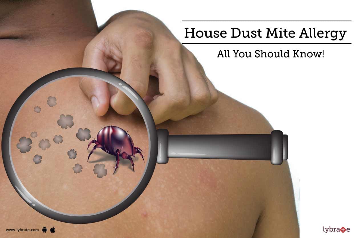 House Dust Mite Allergy - All You Should Know!