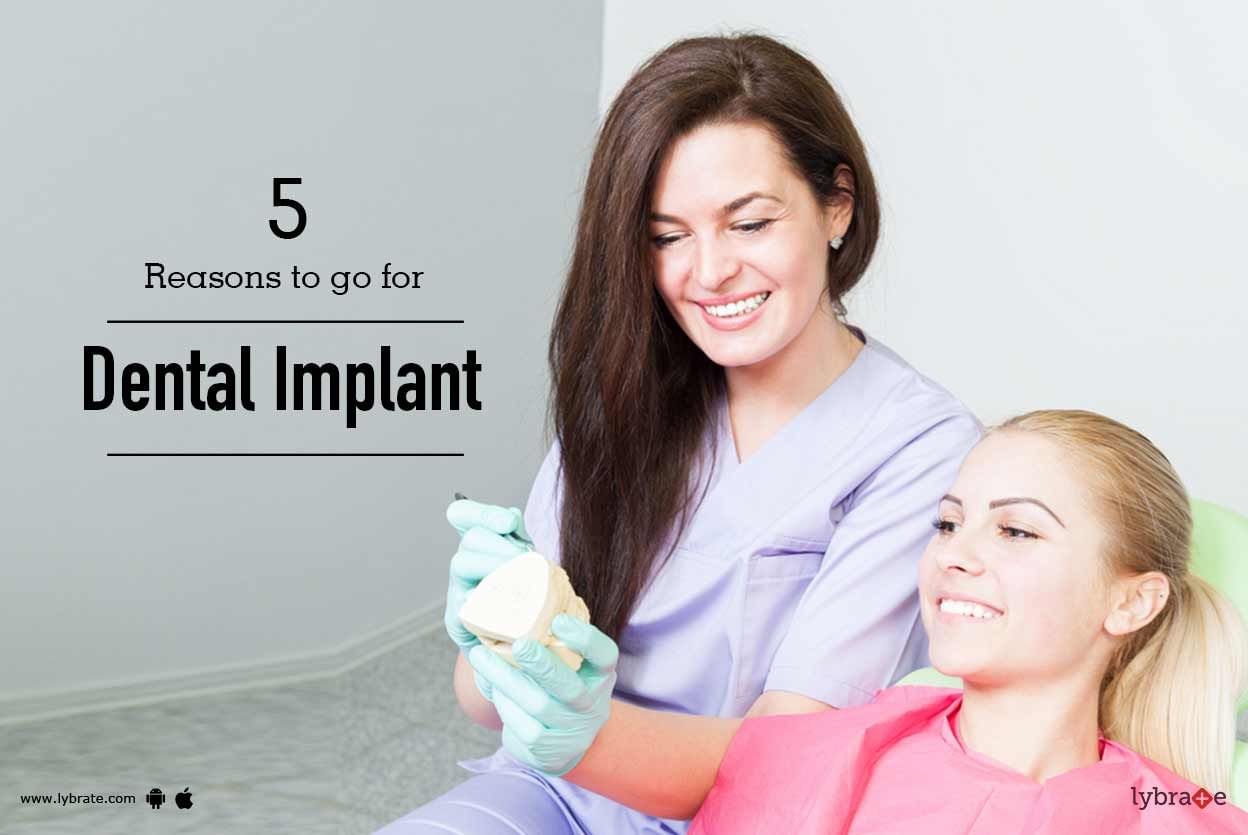5 Reasons to go for Dental Implant