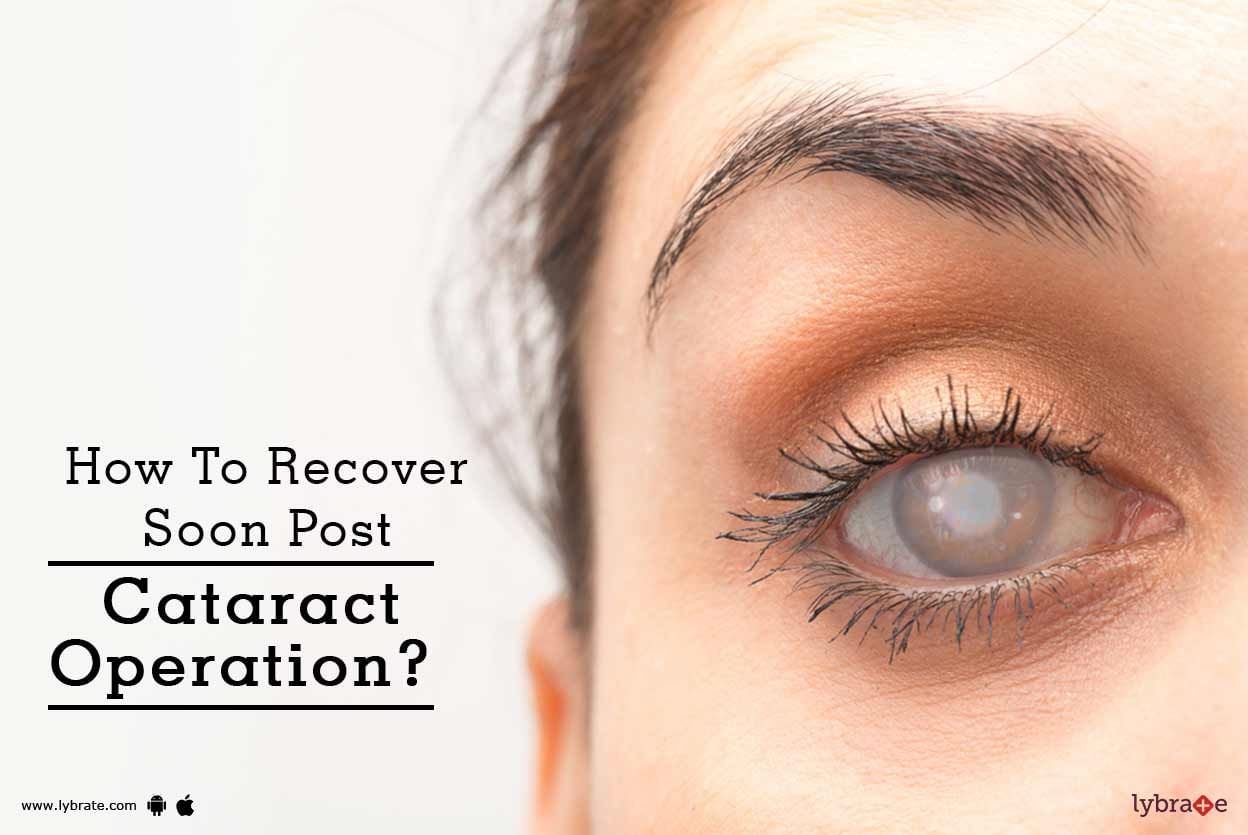 How To Recover Soon Post Cataract Operation?