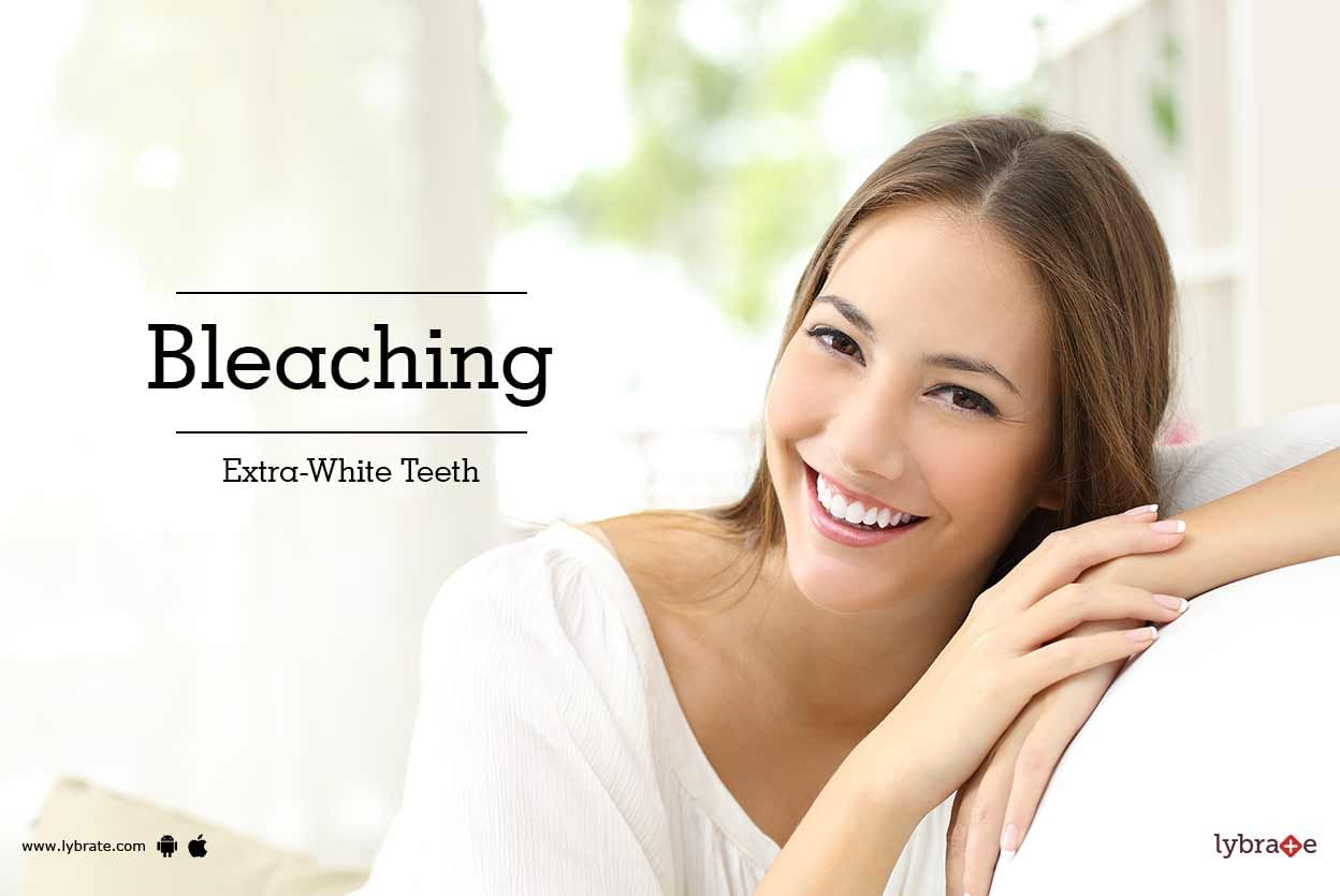 Bleaching: Extra-White Teeth