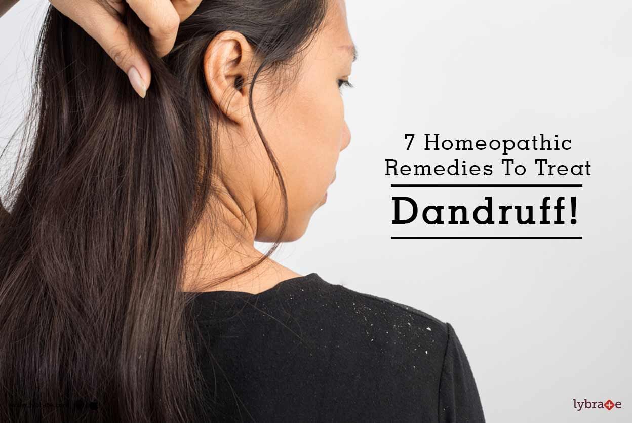 7 Homeopathic Remedies To Treat Dandruff!
