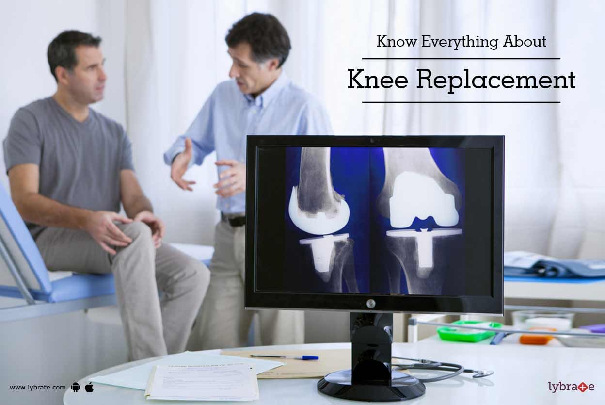 Know Everything About Knee Replacement