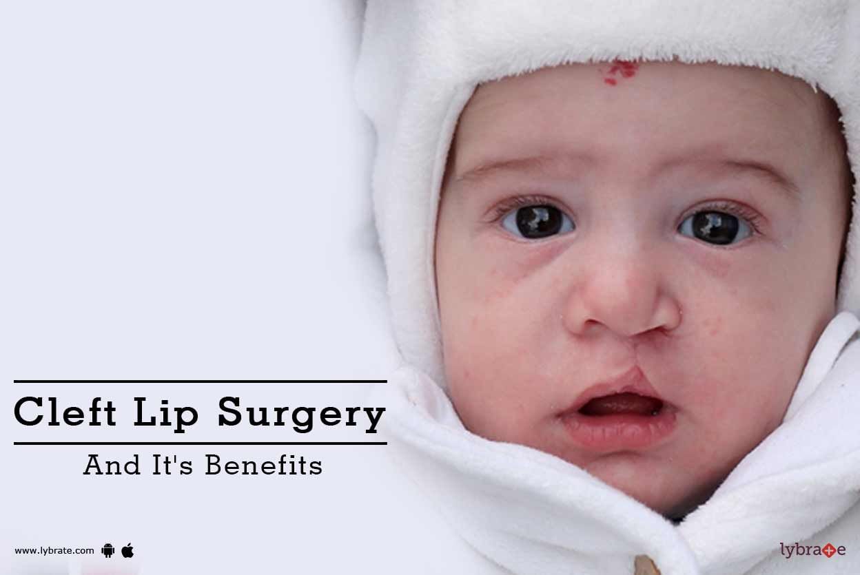 Cleft Lip Surgery And It's Benefits