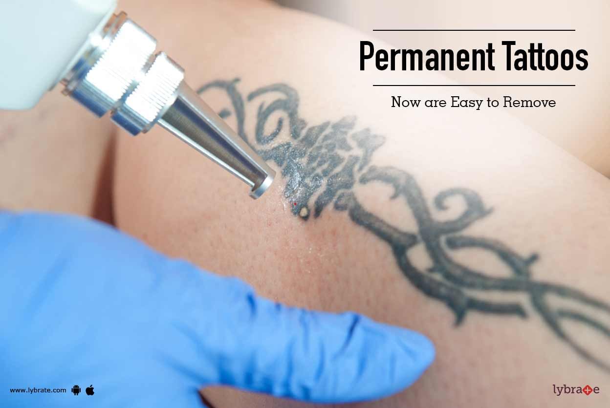 Permanent Tattoos - Now are Easy to Remove