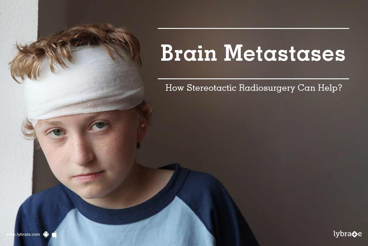 Brain Metastases - How Stereotactic Radiosurgery Can Help?