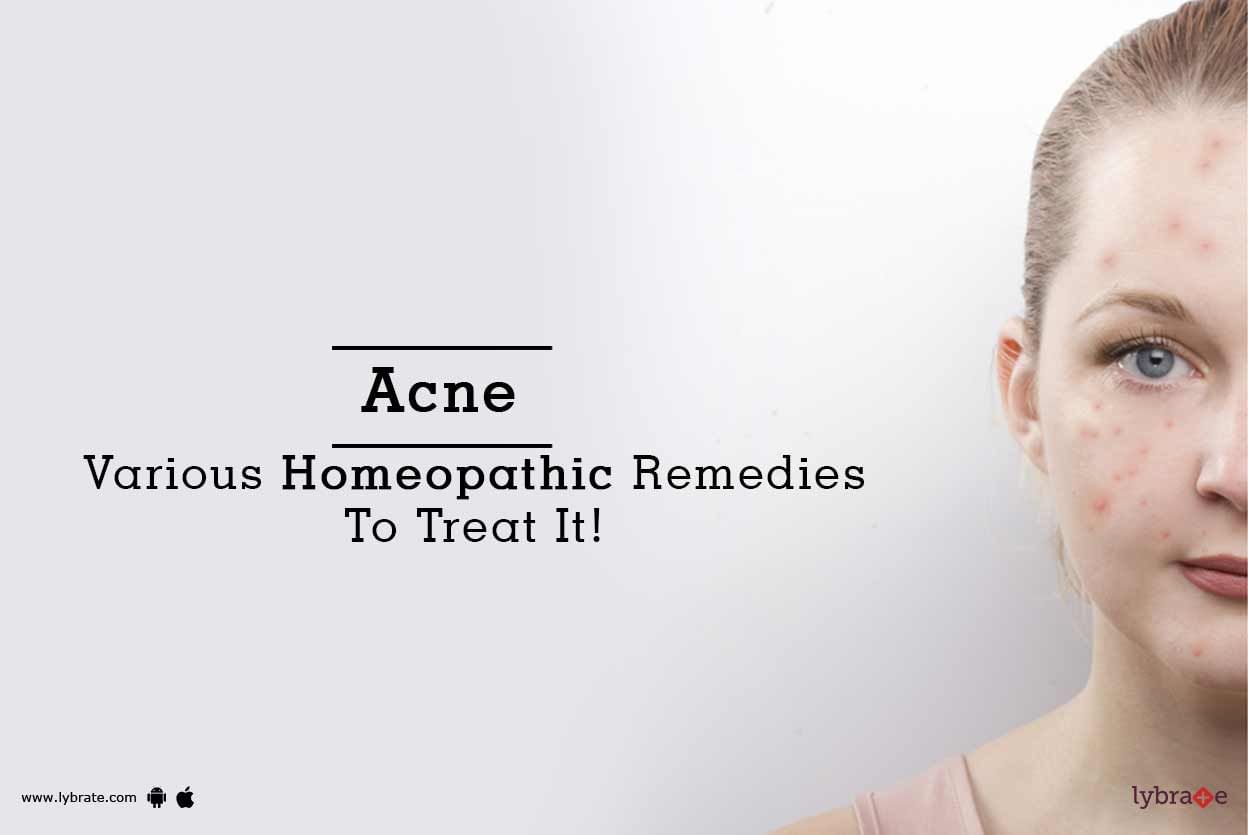 Acne - Various Homeopathic Remedies To Treat It!