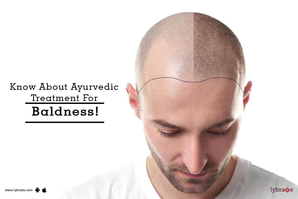 Know About  Ayurvedic Treatment For Baldness!