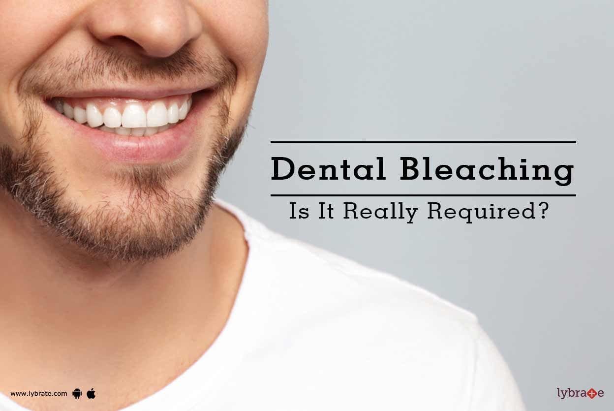 Dental Bleaching - Is It Really Required?