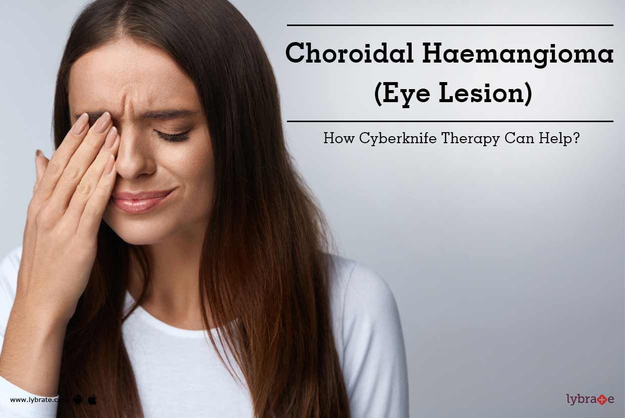 Choroidal Haemangioma (Eye Lesion) - How Cyberknife Therapy Can Help?