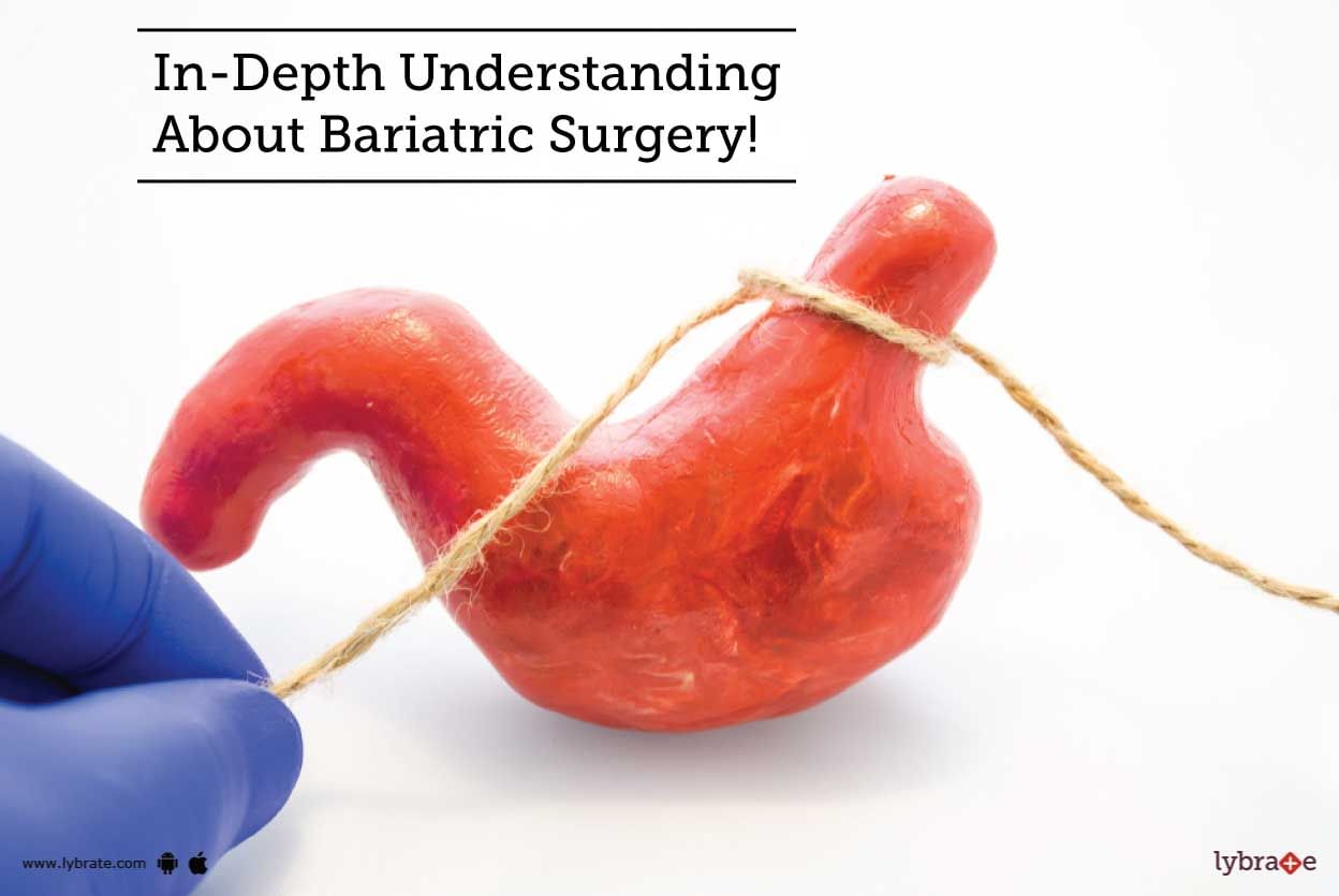 In-Depth Understanding About Bariatric Surgery!