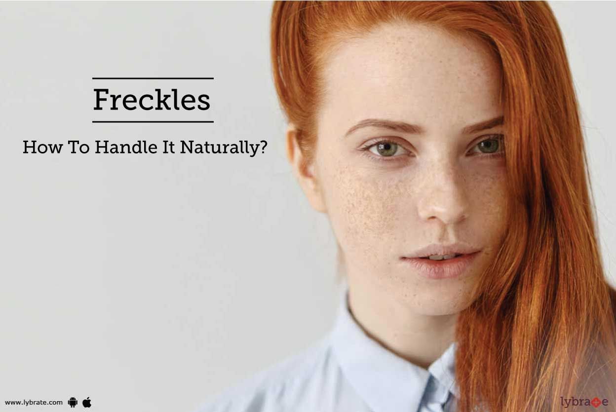 Freckles - How To Handle It Naturally?