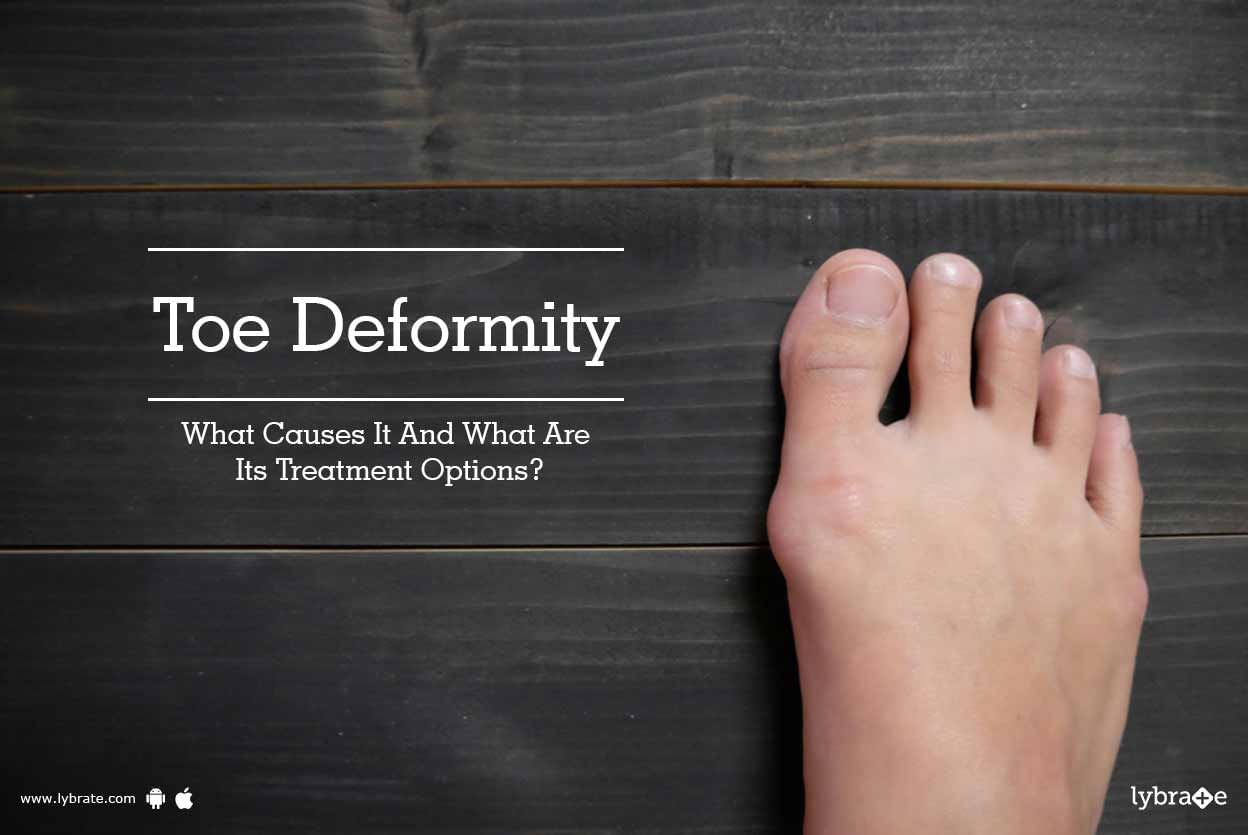 Toe Deformity- What Causes It And What Are Its Treatment Options?