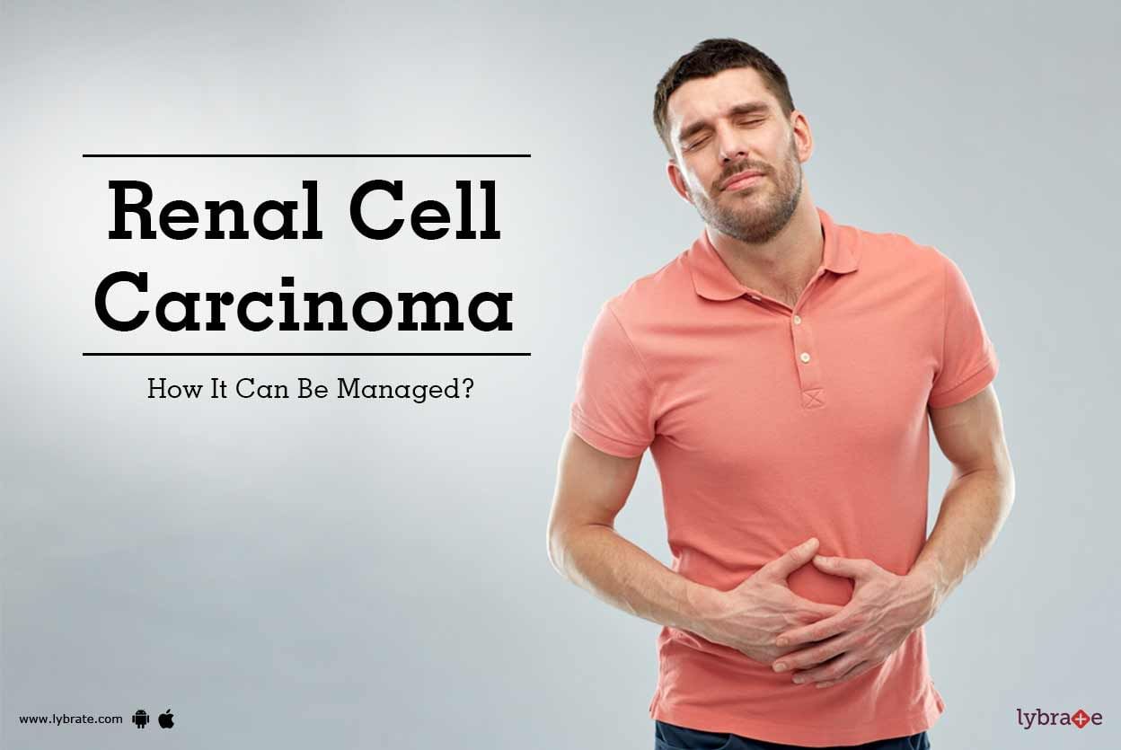 Renal Cell Carcinoma - How It Can Be Managed?