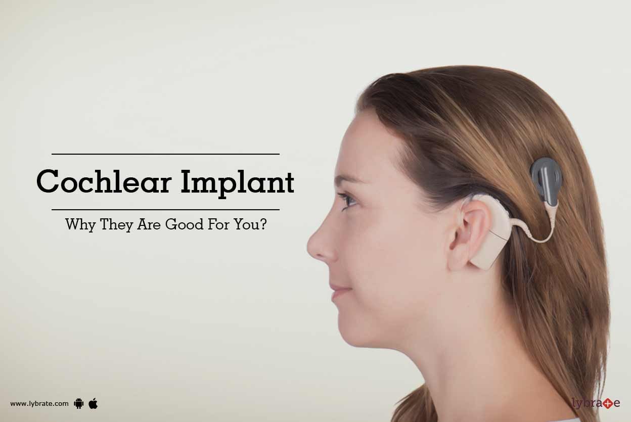 Cochlear Implant - Why They Are Good For You?