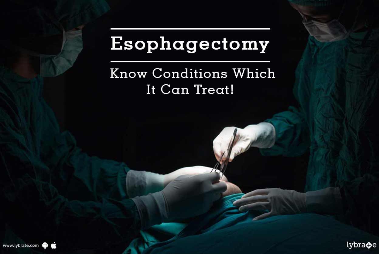 Esophagectomy - Know Conditions Which It Can Treat!
