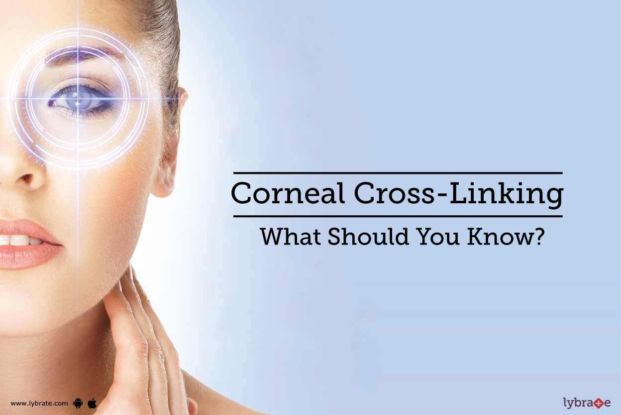 Corneal Cross-Linking - What Should You Know?