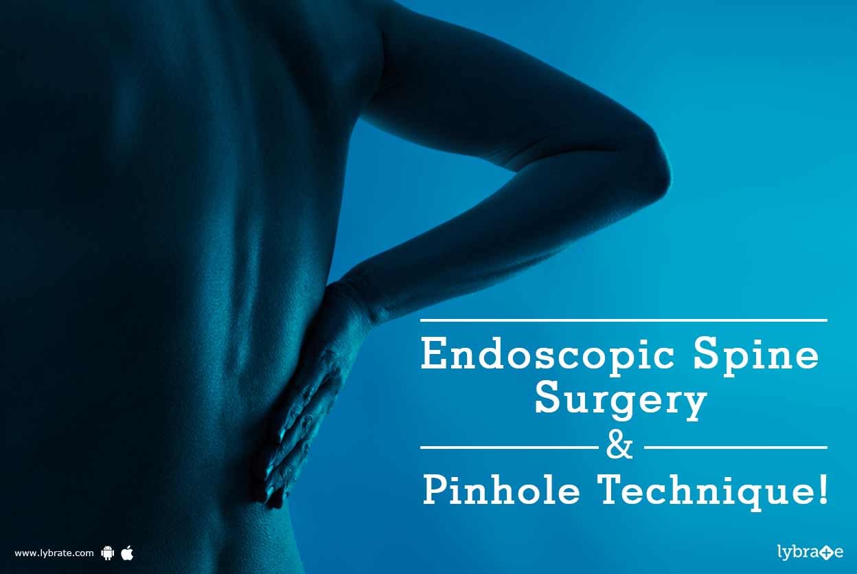 Endoscopic Spine Surgery & Pinhole Technique!
