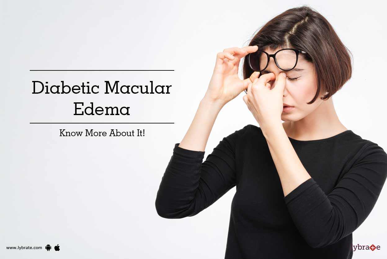 Diabetic Macular Edema - Know More About It!