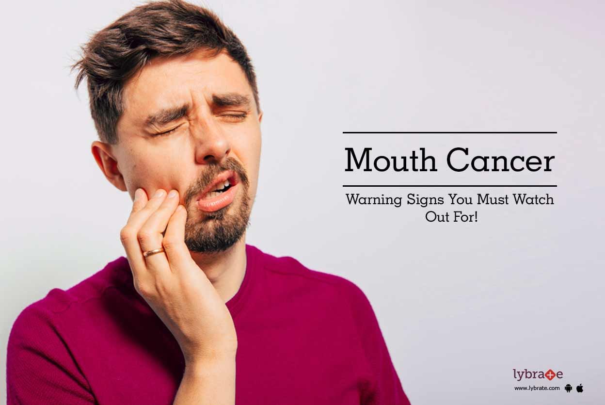 Mouth Cancer - Warning Signs You Must Watch Out For!
