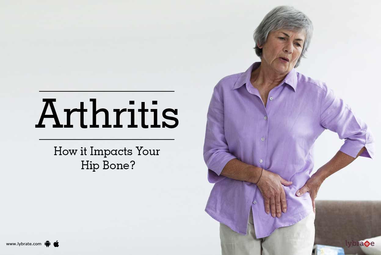 Arthritis - How it Impacts Your Hip Bone?
