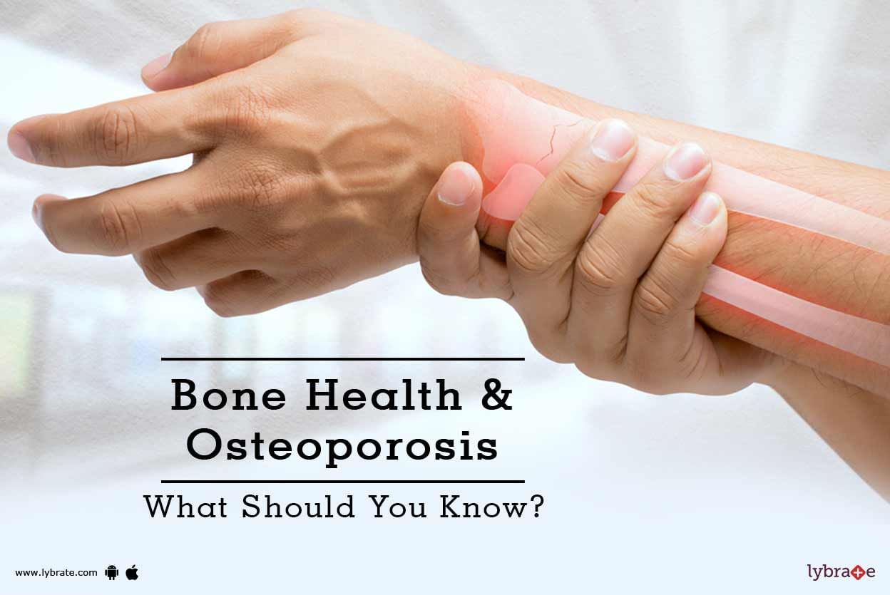 Bone Health & Osteoporosis - What Should You Know?