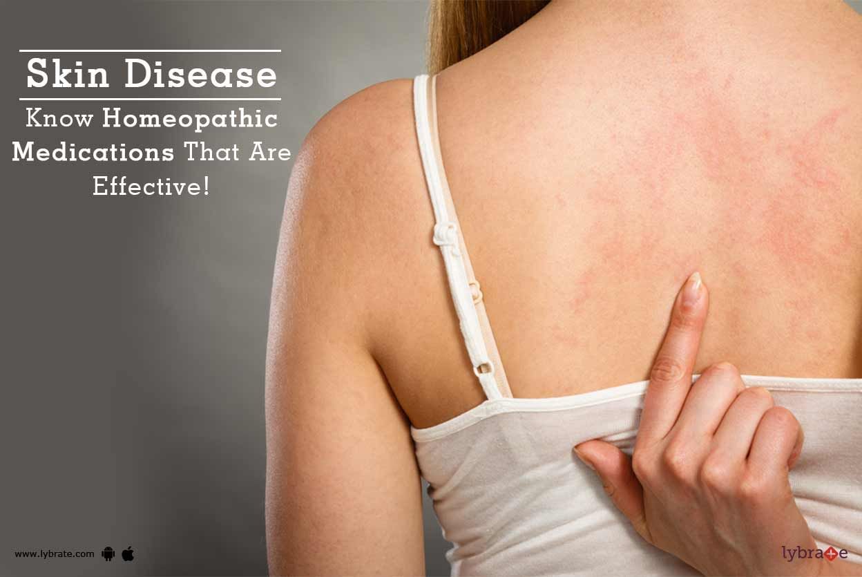 Skin Disease - Know Homeopathic Medications That Are Effective!