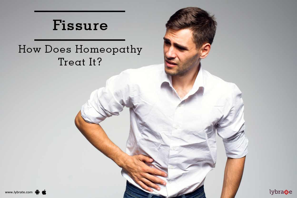 Fissure - How Does Homeopathy Treat It?