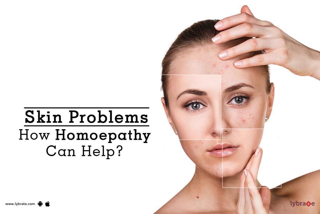 Skin Problems - How Homoepathy Can Help?