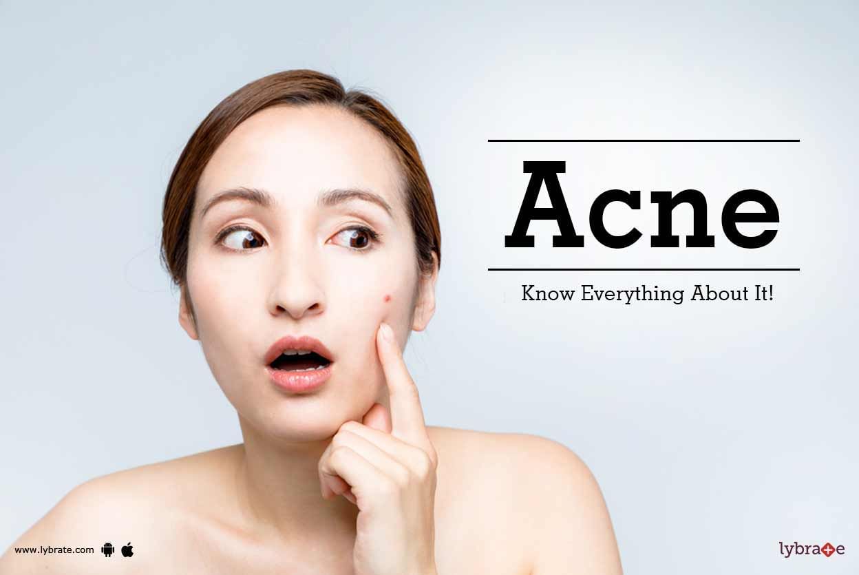 Acne - Know Everything About It!