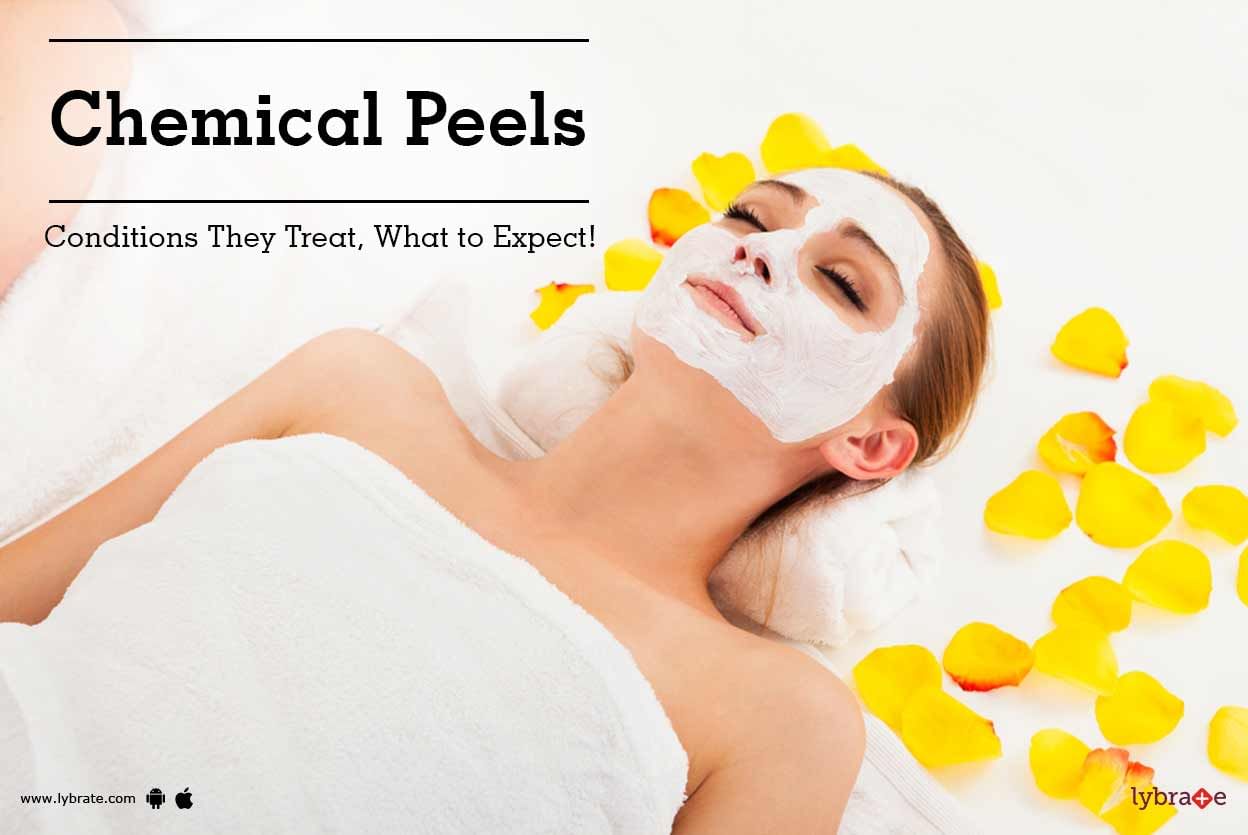 Chemical Peels: Conditions They Treat, What to Expect!