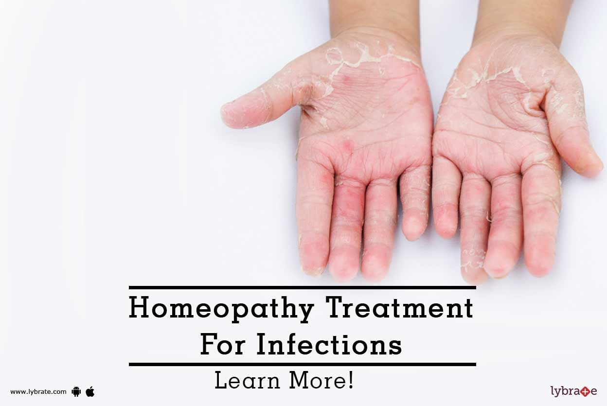 Homeopathy Treatment For Infections - Learn More!