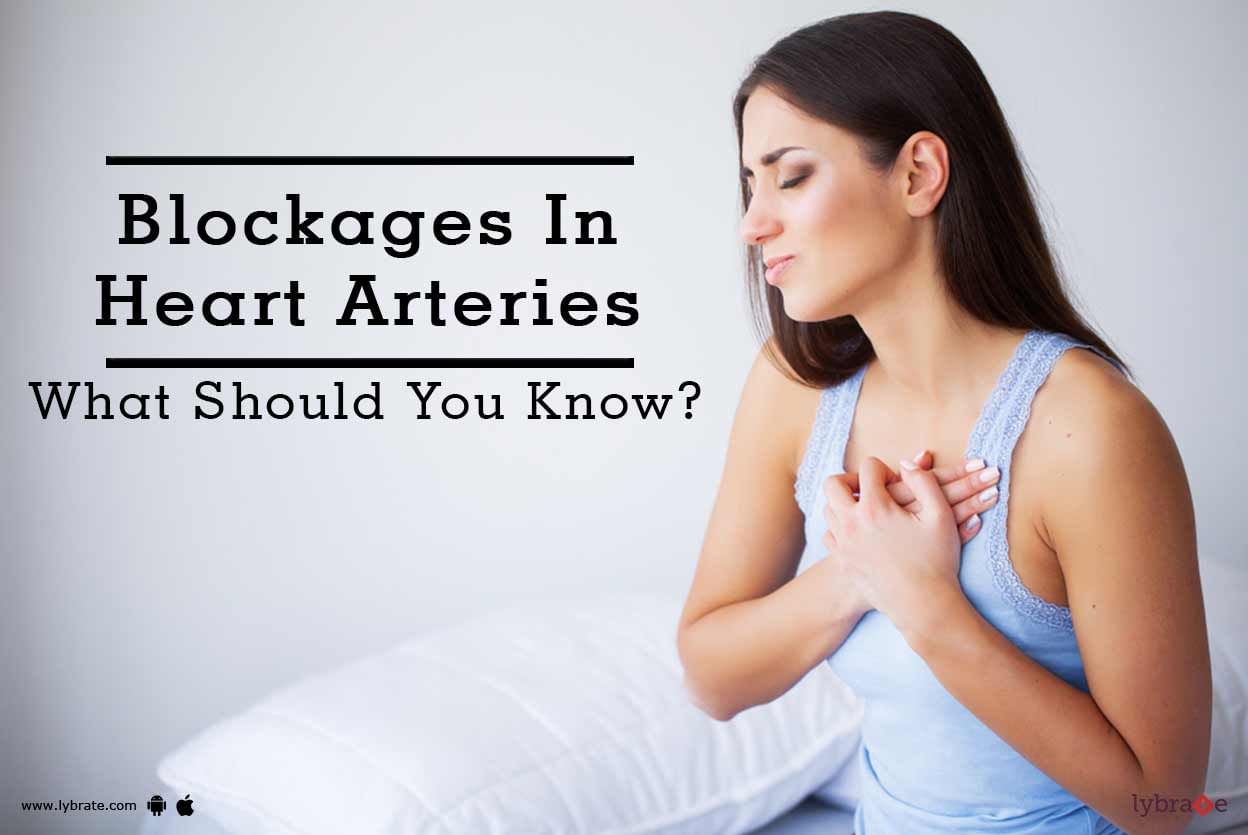 Blockages In Heart Arteries - What Should You Know?