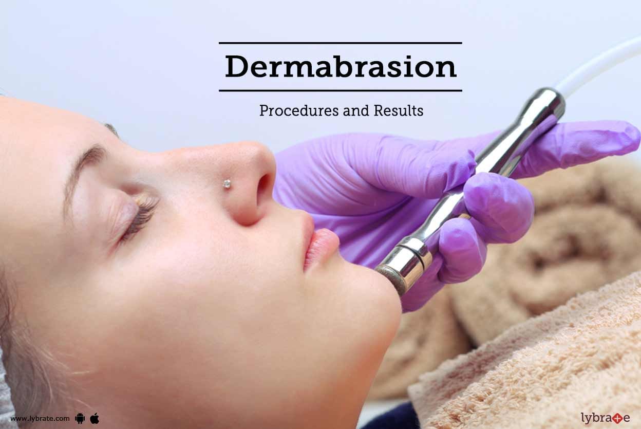 Dermabrasion: Procedures and Results