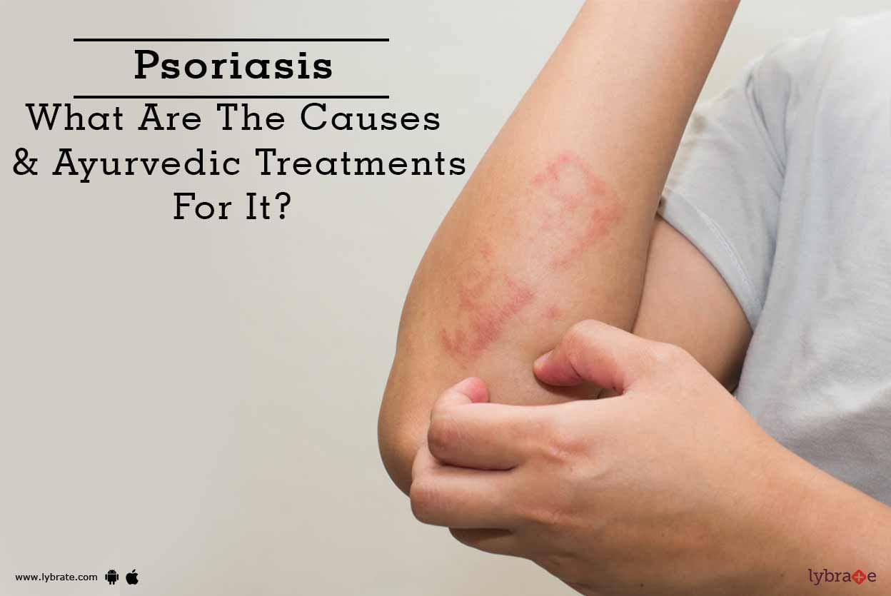 Psoriasis - What Are The Causes & Ayurvedic Treatments For It?