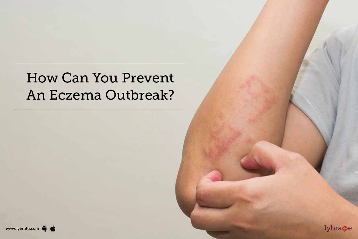 How Can You Prevent An Eczema Outbreak?