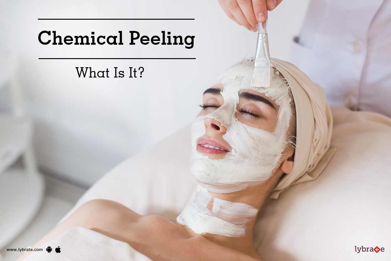 Chemical Peeling - What Is It?