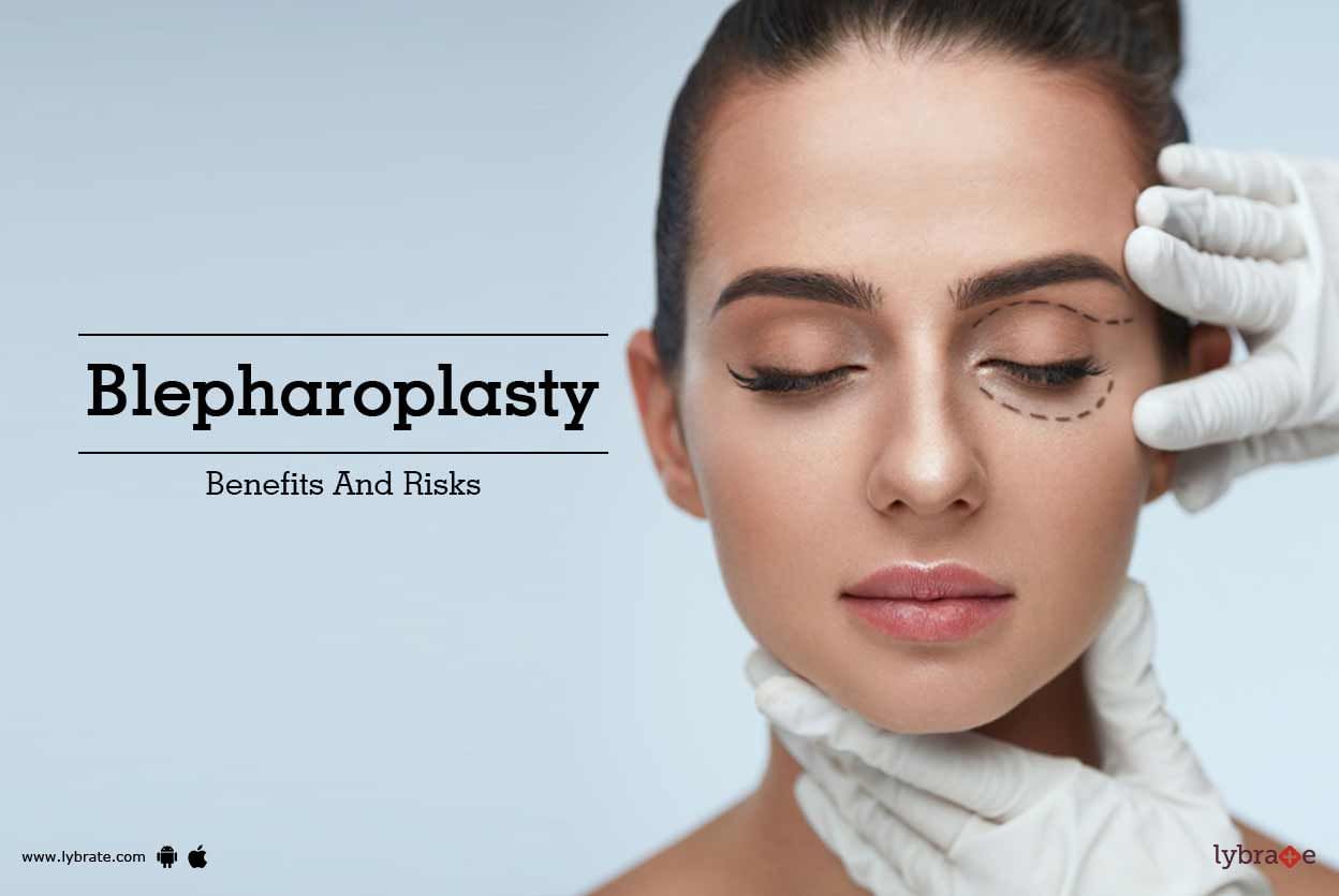Blepharoplasty - Benefits And Risks