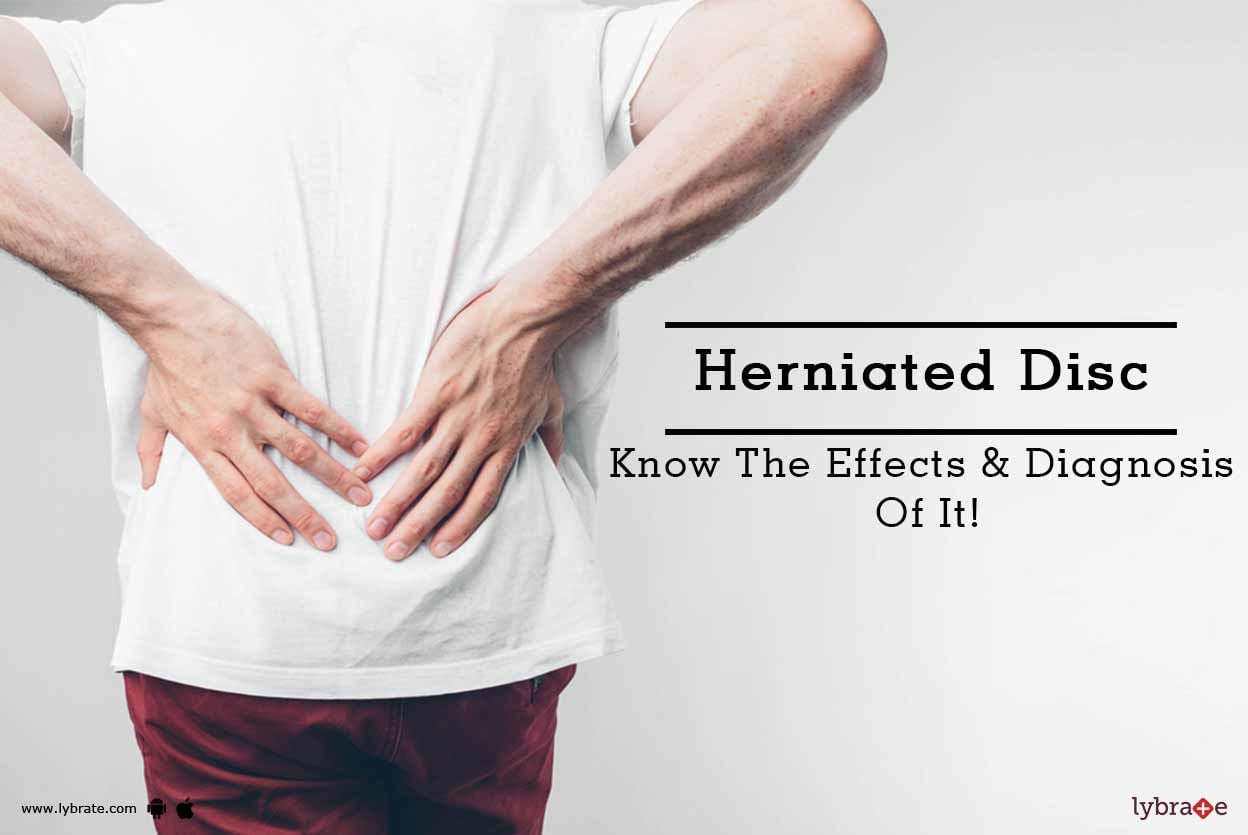 Herniated Disc - Know The Effects & Diagnosis Of It!