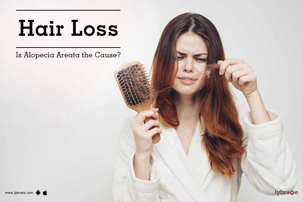 Hair Loss: Is Alopecia Areata the Cause?