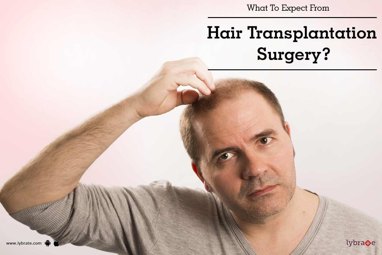 What To Expect From Hair Transplantation Surgery?