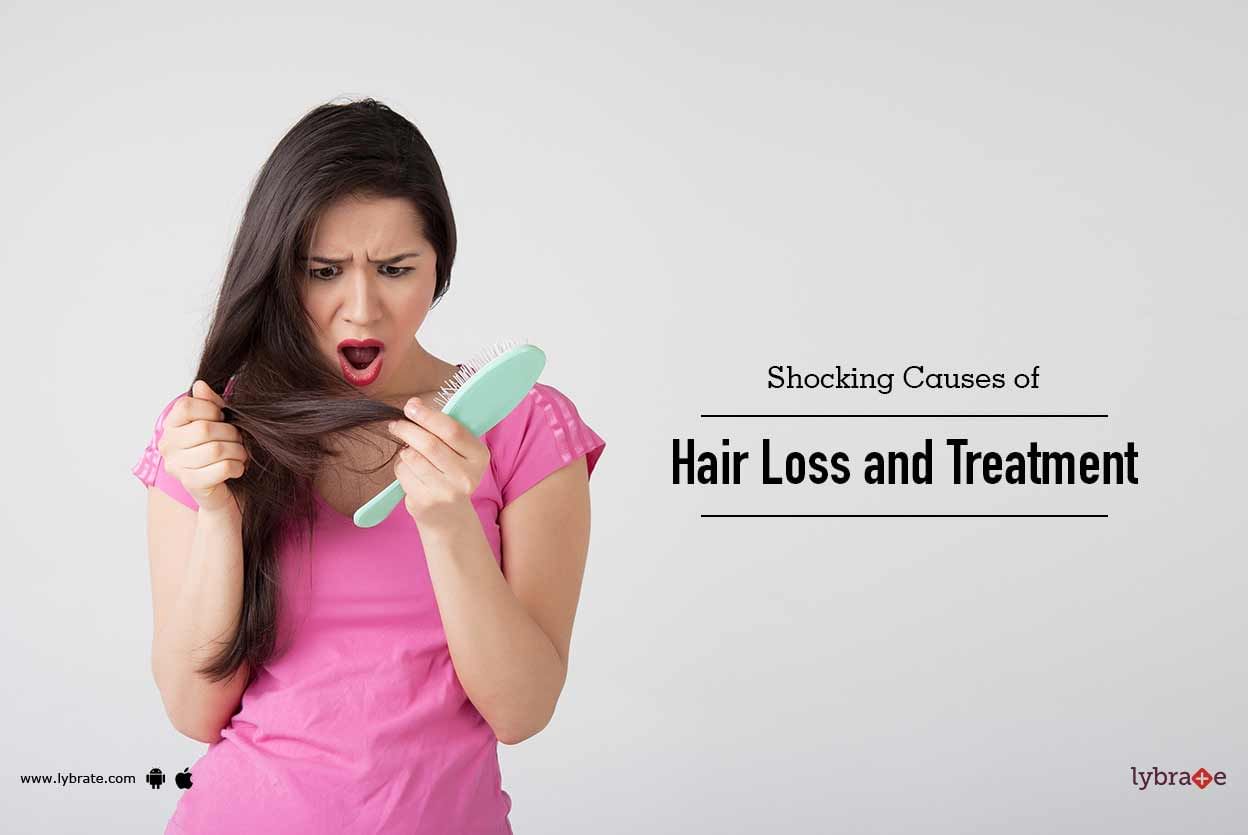 Shocking Causes of Hair Loss and Treatment