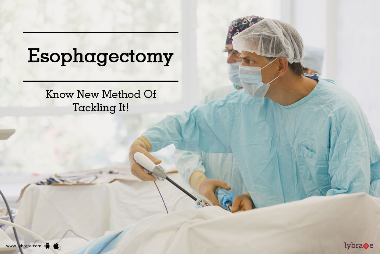Esophagectomy - Know New Method Of Tackling It!
