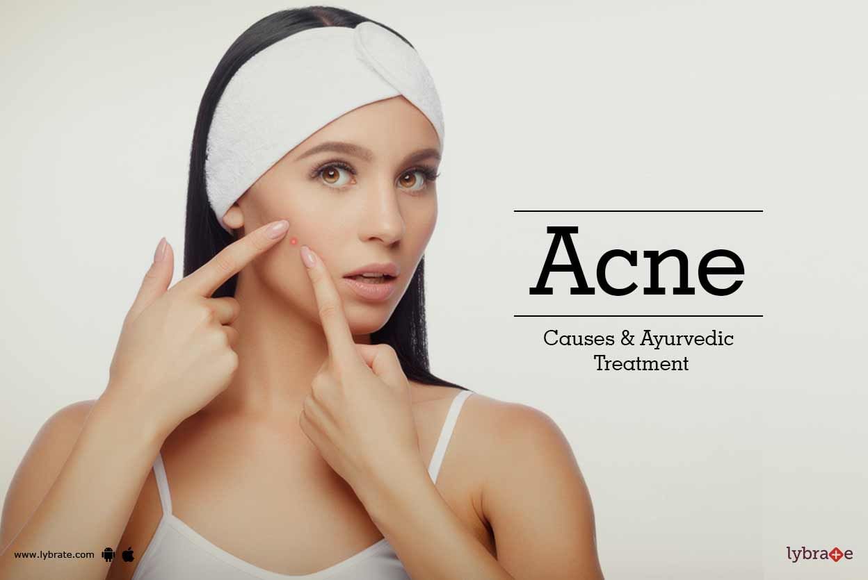 Acne: Causes & Ayurvedic Treatment