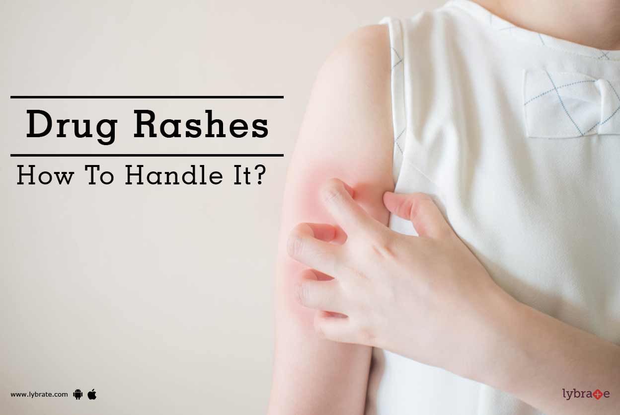 Drug Rashes - How To Handle It?