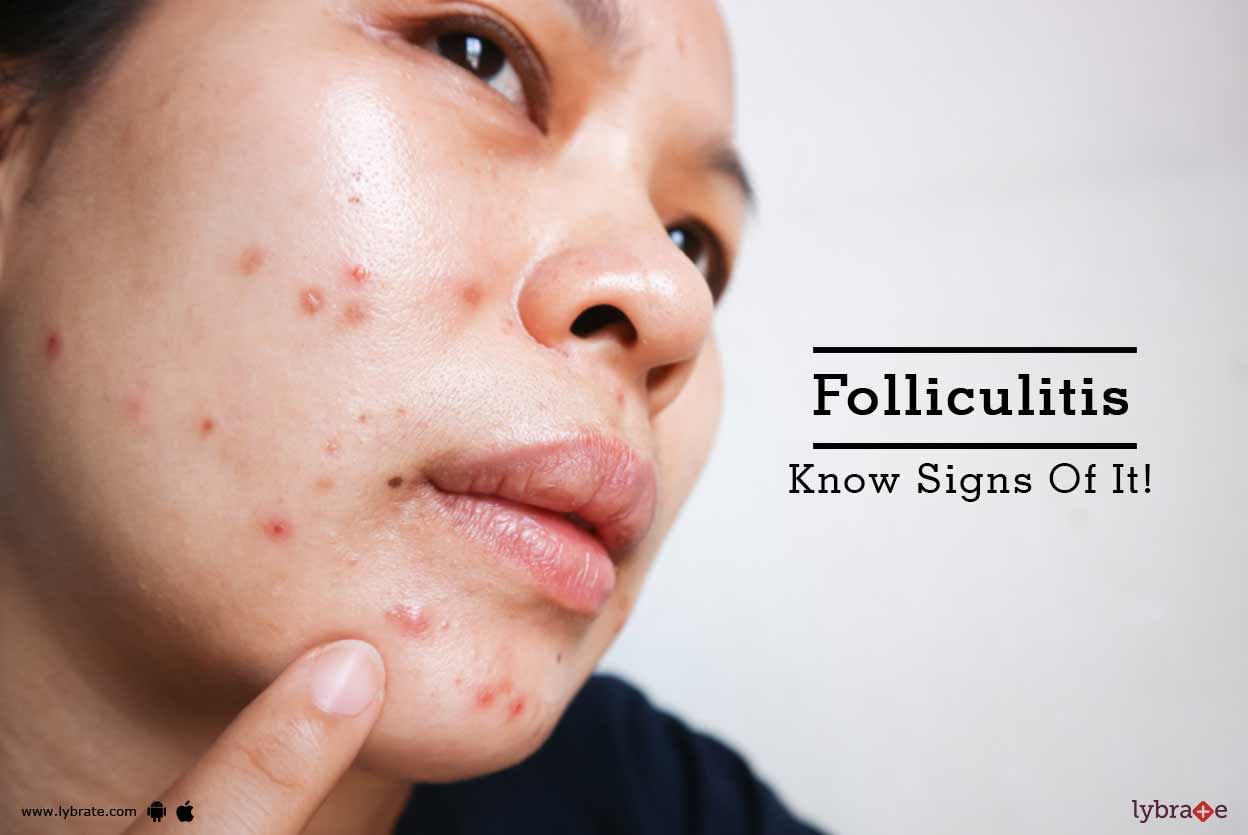 Folliculitis - Know Signs Of It!