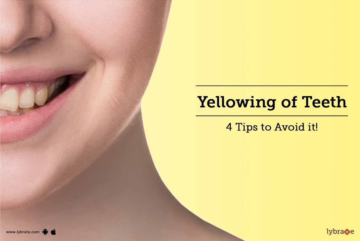 Yellowing of Teeth - 4 Tips to Avoid it!