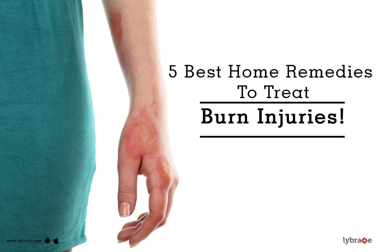 5 Best Home Remedies To Treat Burn Injuries!