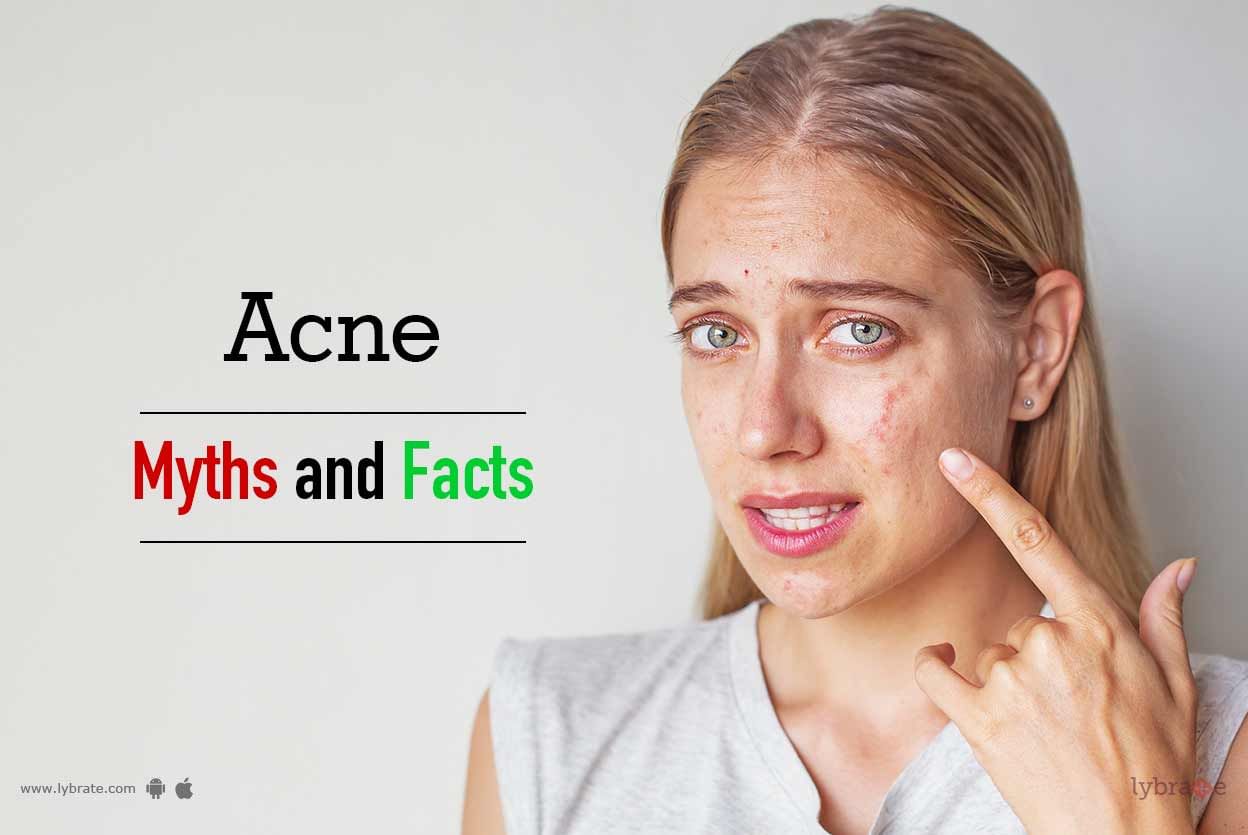 Acne: Myths & Facts