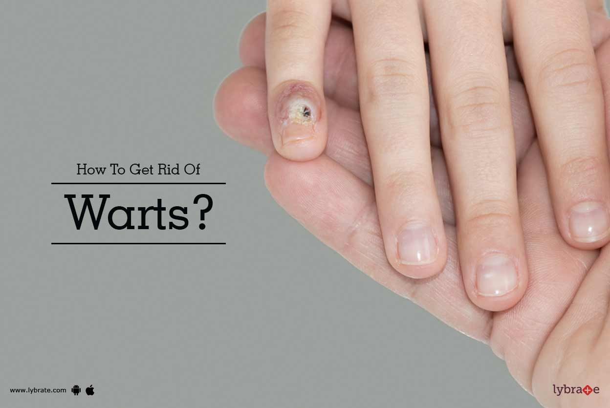 How To Get Rid Of Warts?