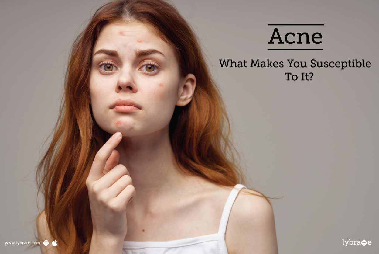 Acne - What Makes You Susceptible To It?